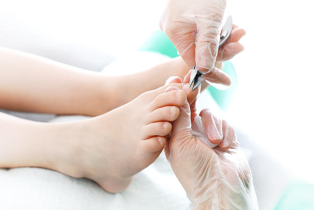 Leczenie wrastających paznokci